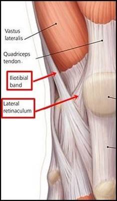 lateral patellar retinaculum 2.jpg