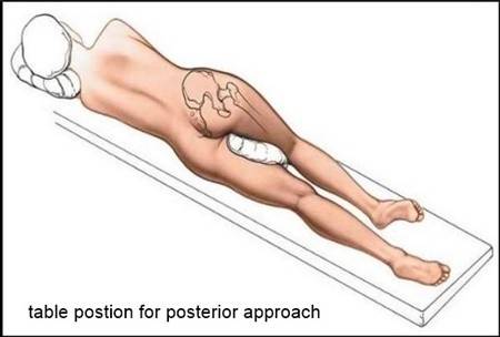 posterior position.JPG