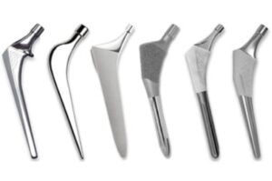 Choosing a Hip Implant (Prosthesis)