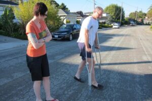 Hip Resurfacing vs. Partial Hip Replacement