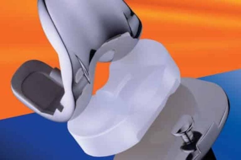 Knee Replacement Implant Materials