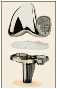knee replacement components