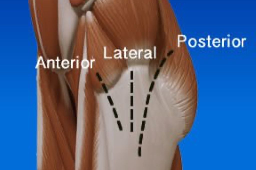 hip replacement incision types